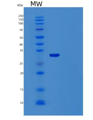 Recombinant Human TMEFF1 Protein,Recombinant Human TMEFF1 Protein