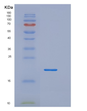 Recombinant Tumor Necrosis Factor Beta (TNFb),Recombinant Tumor Necrosis Factor Beta (TNFb)