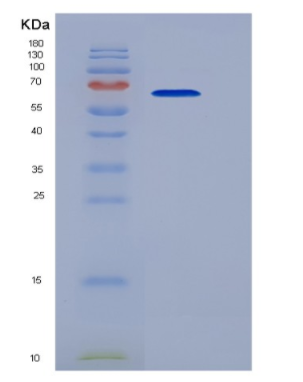 Recombinant Tumor Necrosis Factor Receptor Superfamily, Member 10C (TNFRSF10C),Recombinant Tumor Necrosis Factor Receptor Superfamily, Member 10C (TNFRSF10C)