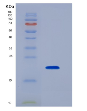 Recombinant Tumor Necrosis Factor Receptor Superfamily, Member 14 (TNFRSF14),Recombinant Tumor Necrosis Factor Receptor Superfamily, Member 14 (TNFRSF14)