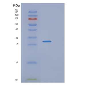 Recombinant Human TBCB Protein,Recombinant Human TBCB Protein