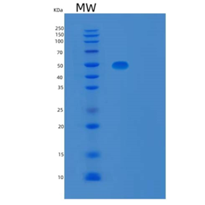 Recombinant Human TBCEL Protein