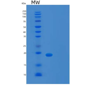 Recombinant Human TCEAL1 Protein,Recombinant Human TCEAL1 Protein