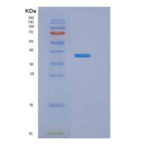 Recombinant Transforming Growth Factor Beta 3 (TGFb3)