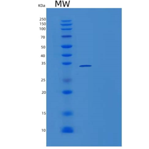 Recombinant Human Recombinant Human BCL6 / B-cell CLL lymphoma 6 Protein (aa 1-150 Protein
