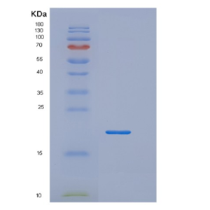 Recombinant Tumor Necrosis Factor Beta (TNFb)