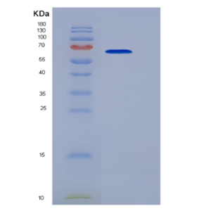 Recombinant Tumor Necrosis Factor Receptor Superfamily, Member 10C (TNFRSF10C),Recombinant Tumor Necrosis Factor Receptor Superfamily, Member 10C (TNFRSF10C)