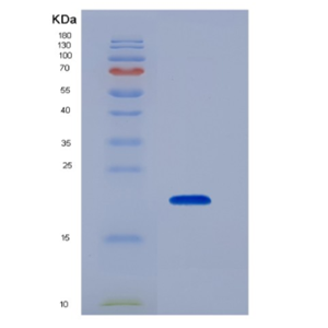 Recombinant Tumor Necrosis Factor Receptor Superfamily, Member 14 (TNFRSF14)