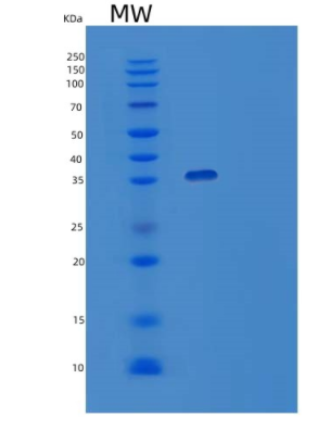 Recombinant Human TPM1 Protein,Recombinant Human TPM1 Protein