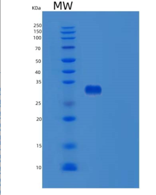 Recombinant Human TPSAB1 Protein,Recombinant Human TPSAB1 Protein