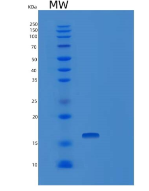 Recombinant Human TSC22D3 Protein,Recombinant Human TSC22D3 Protein