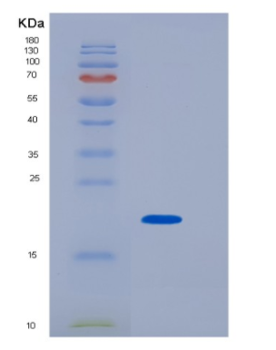 Recombinant Human TSG101 Protein,Recombinant Human TSG101 Protein