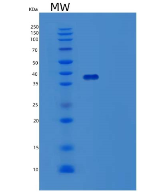 Recombinant Human TSTA3 Protein,Recombinant Human TSTA3 Protein