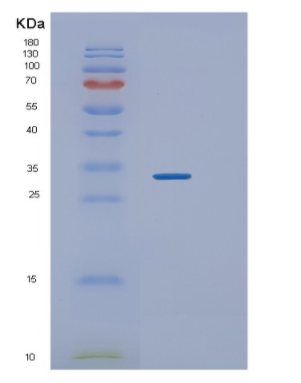 Recombinant Human TWF1 Protein,Recombinant Human TWF1 Protein