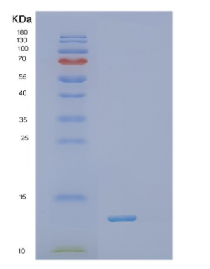 Recombinant Human TXN Protein,Recombinant Human TXN Protein