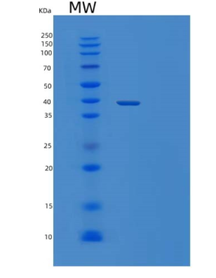 Recombinant Human TYW5 Protein,Recombinant Human TYW5 Protein