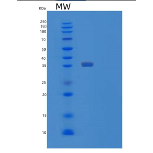 Recombinant Human TOMM34 Protein