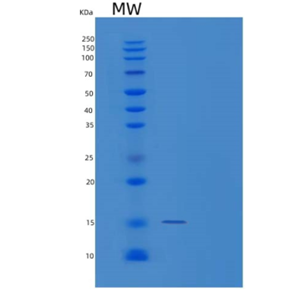 Recombinant Human TP53AIP1 Protein,Recombinant Human TP53AIP1 Protein