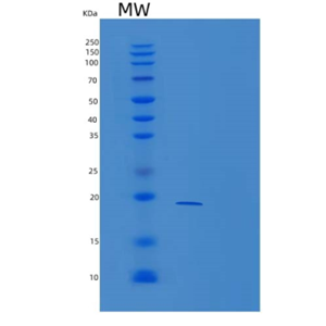Recombinant Human TRAPPC2L Protein