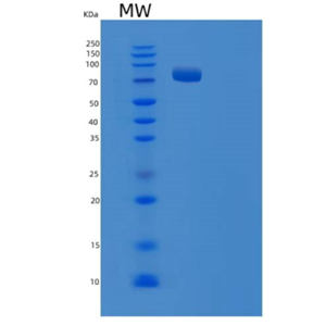 Recombinant E.coli TRS (Threonyl-tRNA synthetase) Protein