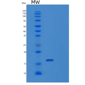 Recombinant Human TSC22D3 Protein,Recombinant Human TSC22D3 Protein