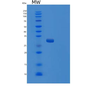 Recombinant Human TRPT1 Protein,Recombinant Human TRPT1 Protein