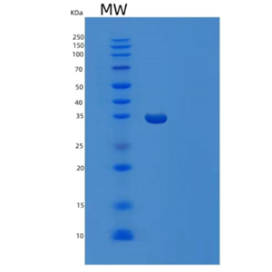 Recombinant Human TRIP10 Protein