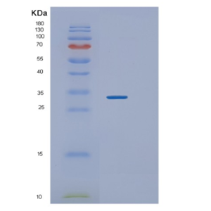 Recombinant Human TWF1 Protein,Recombinant Human TWF1 Protein