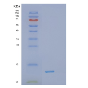 Recombinant Human TXN Protein,Recombinant Human TXN Protein