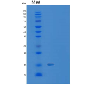 Recombinant Human TXNRD3NB Protein,Recombinant Human TXNRD3NB Protein