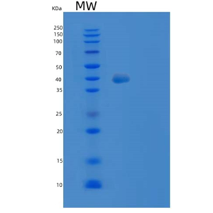 Recombinant Human Tymidylate synthase Protein