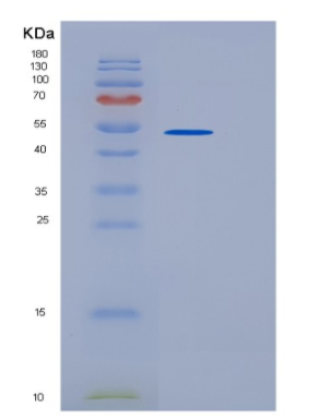 Recombinant Human UBA3 Protein,Recombinant Human UBA3 Protein