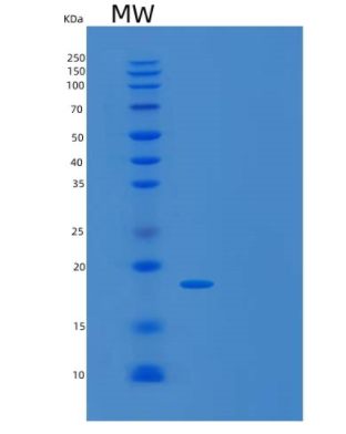 Recombinant Human UBL4A Protein,Recombinant Human UBL4A Protein