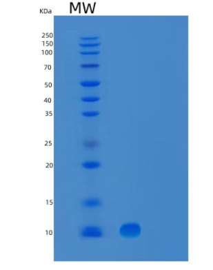 Recombinant Human UBL5 Protein,Recombinant Human UBL5 Protein