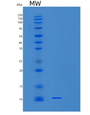 Recombinant Human UFM1 Protein,Recombinant Human UFM1 Protein