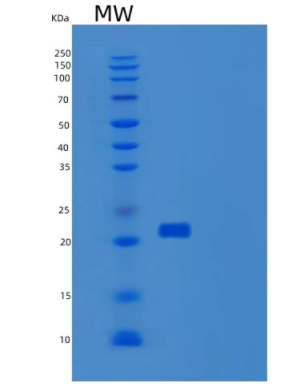 Recombinant Human UPK3A Protein,Recombinant Human UPK3A Protein