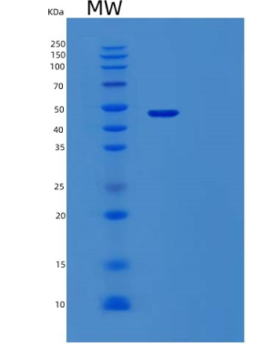 Recombinant Human Vaspin Protein,Recombinant Human Vaspin Protein