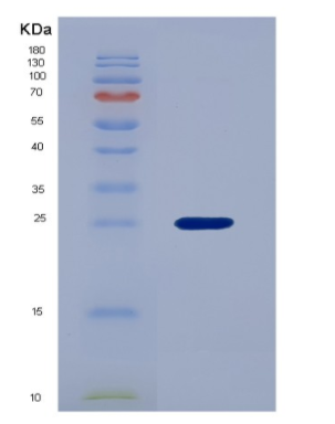 Recombinant Vascular Endothelial Growth Factor B (VEGFB),Recombinant Vascular Endothelial Growth Factor B (VEGFB)