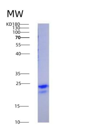 Eukaryotic Vascular Endothelial Growth Factor 165 (VEGF165),Eukaryotic Vascular Endothelial Growth Factor 165 (VEGF165)