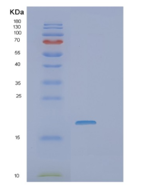 Recombinant Human VEGF165 Protein,Recombinant Human VEGF165 Protein