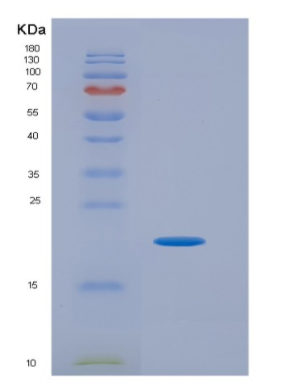 Eukaryotic Vascular Endothelial Growth Factor C (VEGFC),Eukaryotic Vascular Endothelial Growth Factor C (VEGFC)