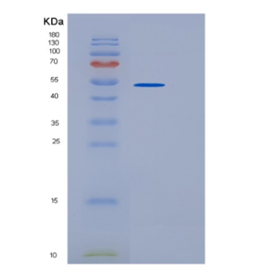 Recombinant Human UBA3 Protein,Recombinant Human UBA3 Protein