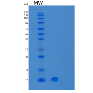 Recombinant Human UBL5 Protein,Recombinant Human UBL5 Protein