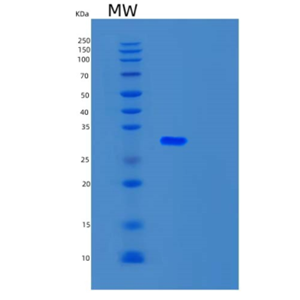 Recombinant Human UBTD2 Protein