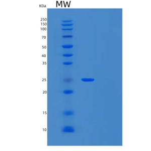 Recombinant Human ULBP1 Protein,Recombinant Human ULBP1 Protein