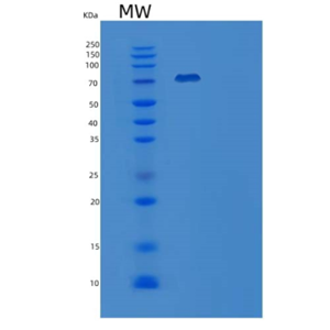 Recombinant Mouse Vascular cell adhesion protein 1
