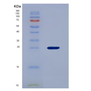 Recombinant Vascular Endothelial Growth Factor B (VEGFB),Recombinant Vascular Endothelial Growth Factor B (VEGFB)