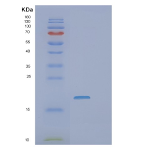 Recombinant Human VEGF165 Protein