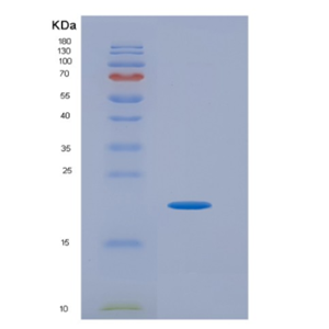 Eukaryotic Vascular Endothelial Growth Factor C (VEGFC)