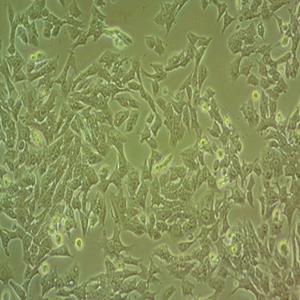 22RV1人细胞,Human rv221 cells